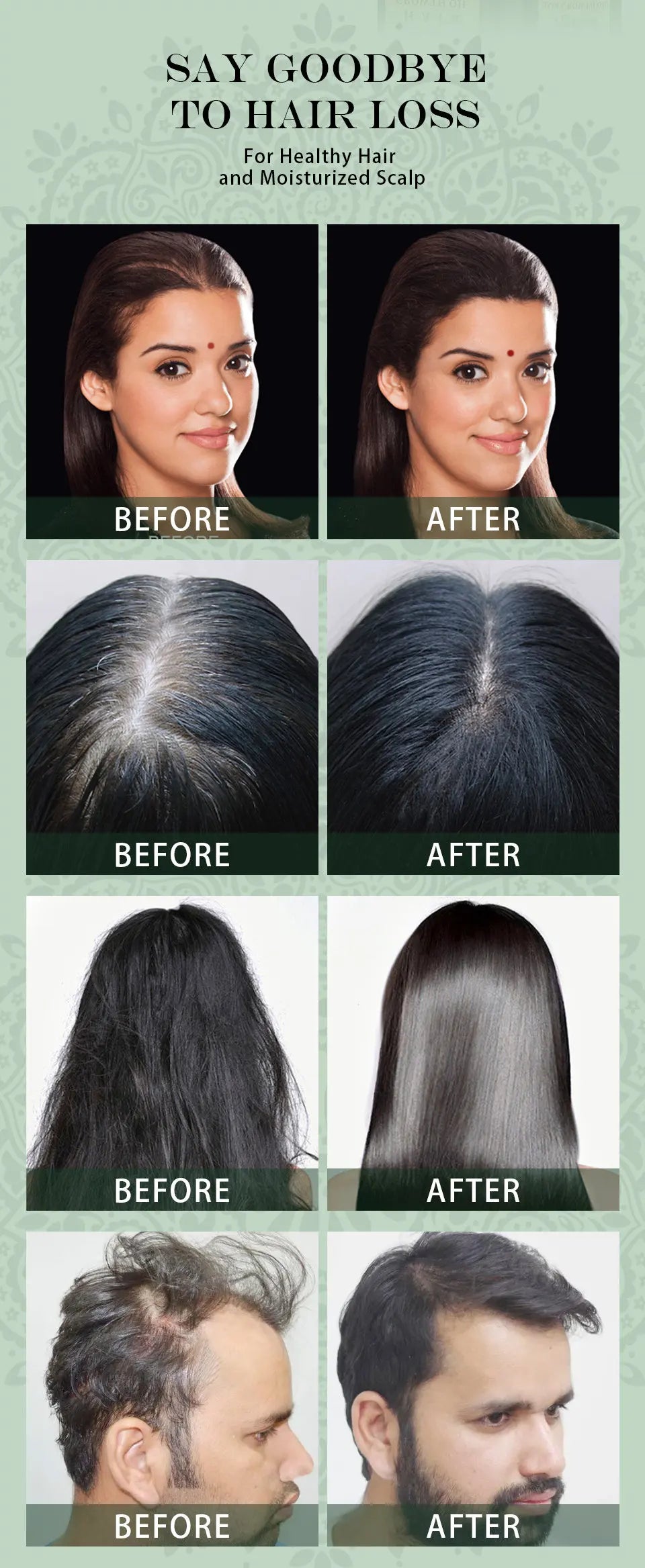 Ayurvedic Hair Growth Oil Adivasi Organic Hair Growth Serum Pure Plant Hair Growth Oil Anti Hair Loss Fast Regrowth Haircare